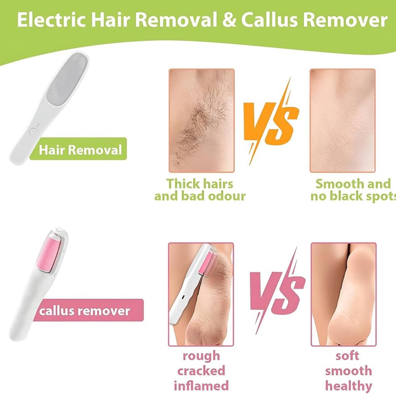 Epilues dhe heqës kallosh 2 në 1