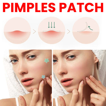 Pimples Patch në formë yjesh