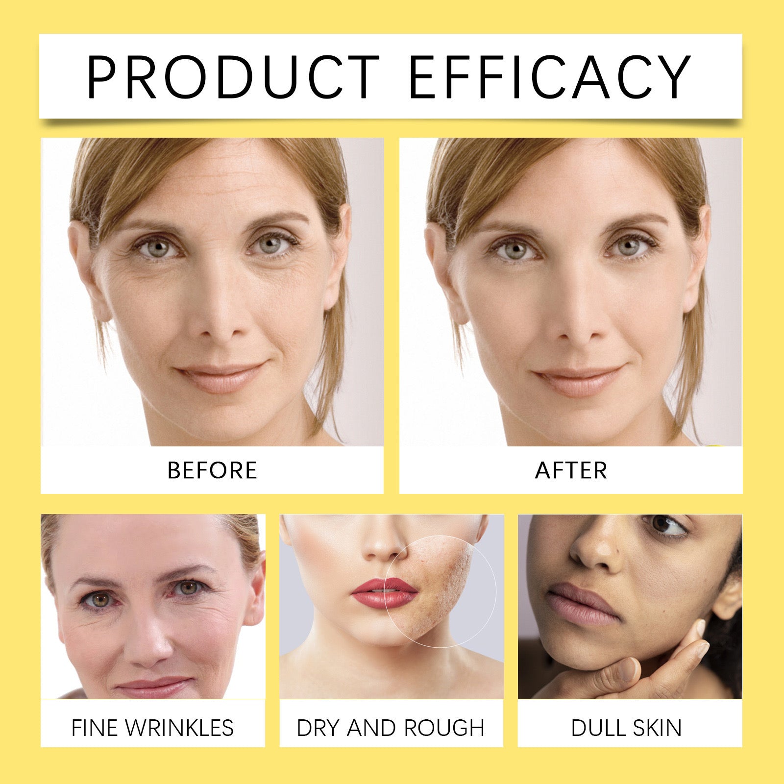 Hidratues me ekstrakt kërmilli (All in one cream)