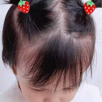 Set me 10 lidhëse flokësh të vogla me fruta dhe perime